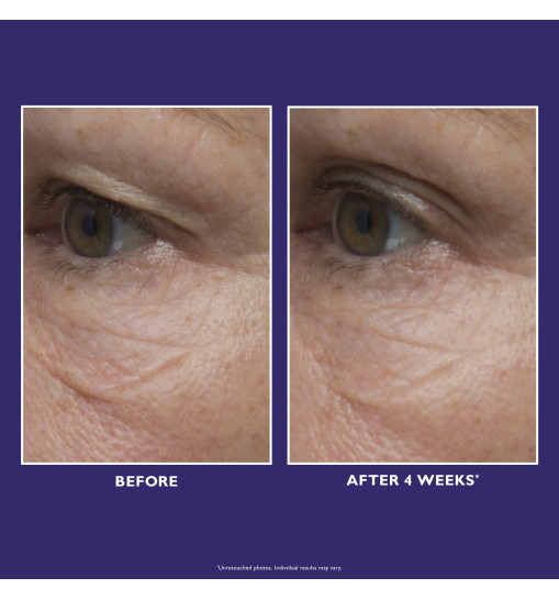 Peter Thomas Roth Ultimate Solution 5™ Multitasking Eye Cream - Багатофункціональний крем для шкіри навколо очей