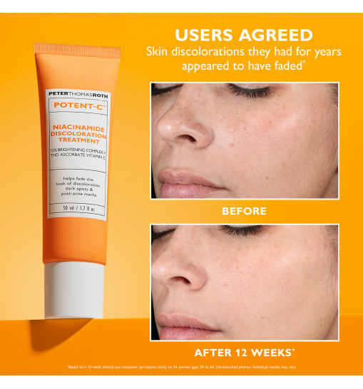 Peter Thomas Roth Potent-C Niacinamide Discoloration Treatment - Крем-гель з ніацинамідом та вітаміном С для вирівнювання тону шкіри